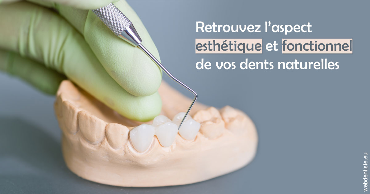 https://dr-taverniers-jeroen.chirurgiens-dentistes.fr/Restaurations dentaires 1