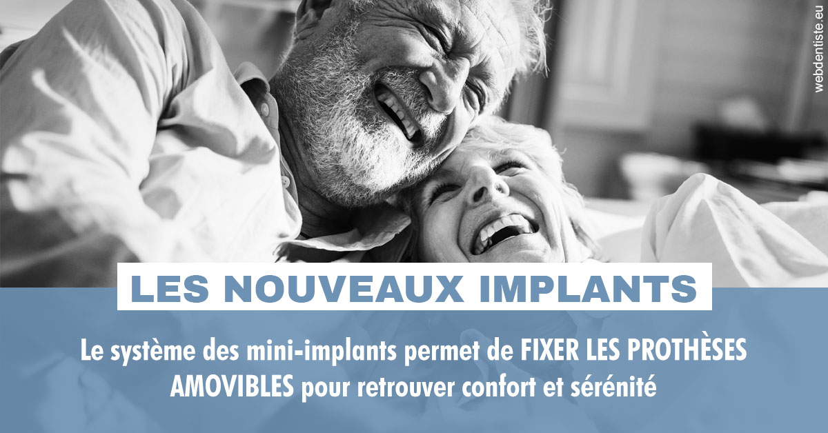 https://dr-taverniers-jeroen.chirurgiens-dentistes.fr/Les nouveaux implants 2