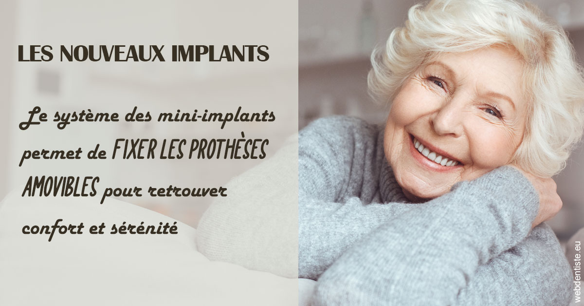https://dr-taverniers-jeroen.chirurgiens-dentistes.fr/Les nouveaux implants 1