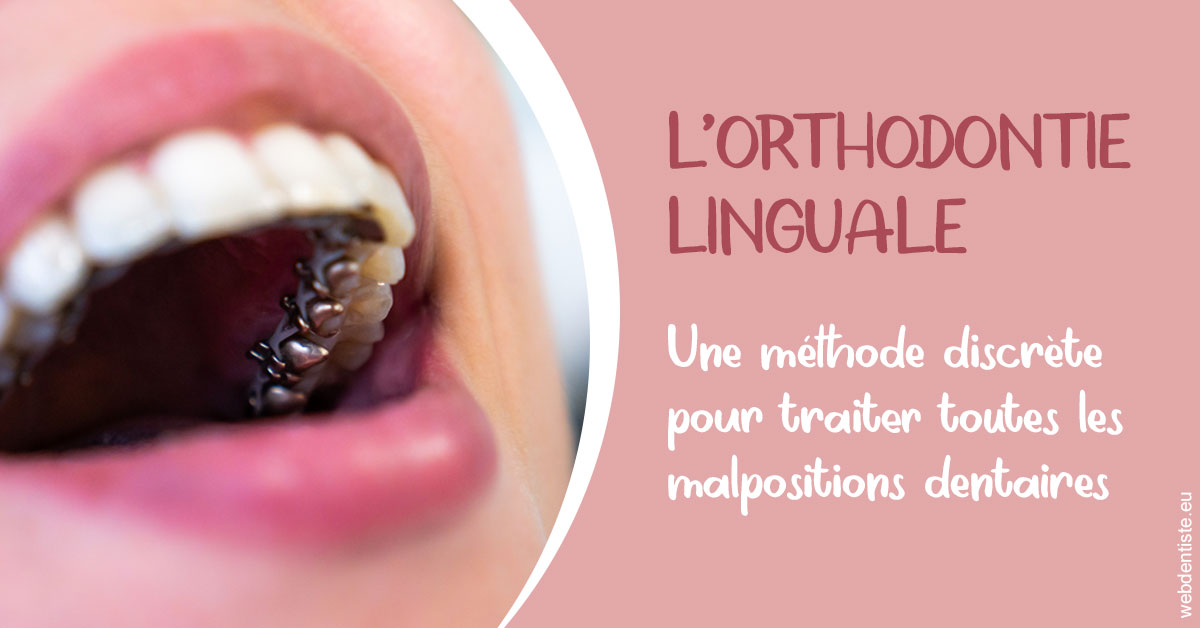 https://dr-taverniers-jeroen.chirurgiens-dentistes.fr/L'orthodontie linguale 2