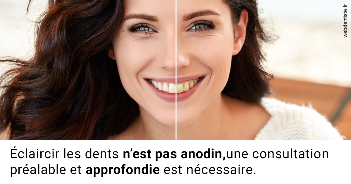 https://dr-taverniers-jeroen.chirurgiens-dentistes.fr/Le blanchiment 2