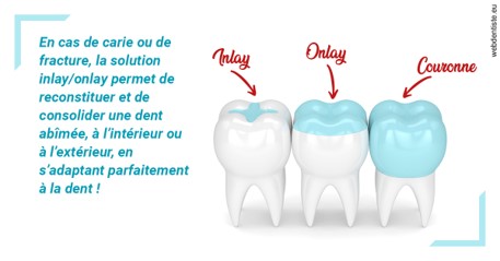 https://dr-taverniers-jeroen.chirurgiens-dentistes.fr/L'INLAY ou l'ONLAY