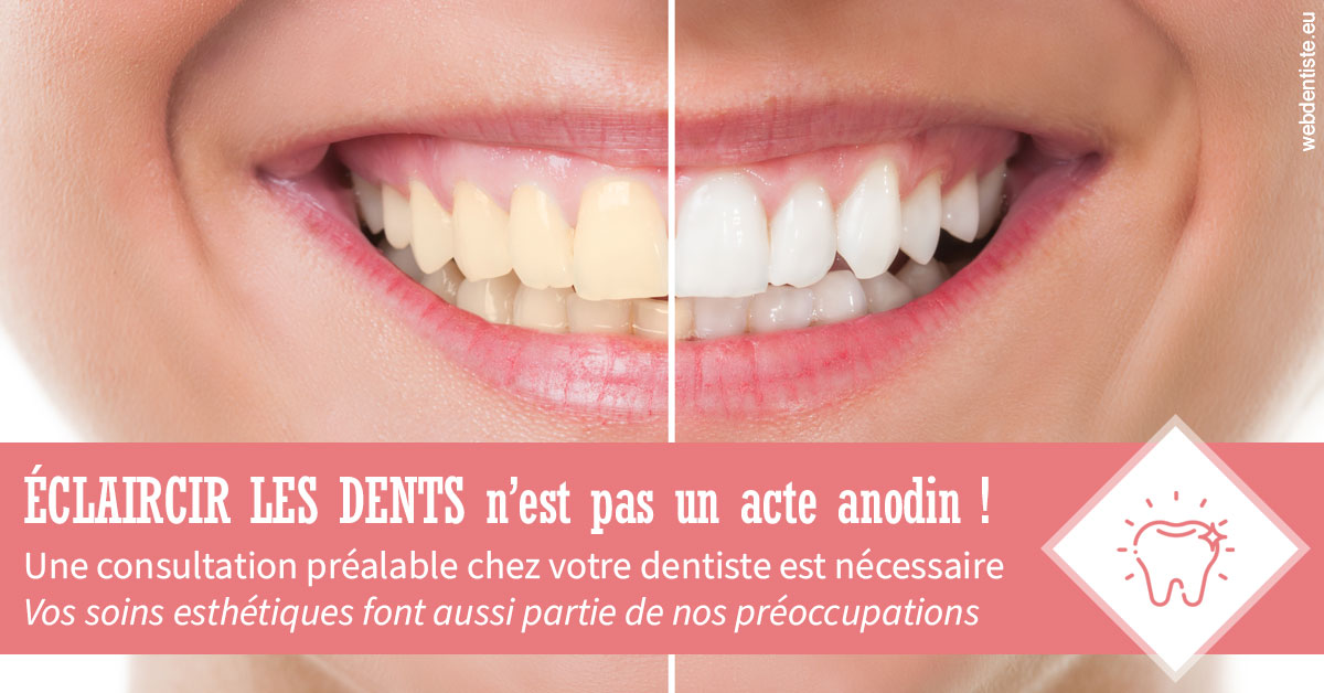 https://dr-taverniers-jeroen.chirurgiens-dentistes.fr/Eclaircir les dents 1