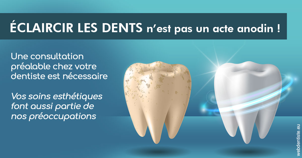 https://dr-taverniers-jeroen.chirurgiens-dentistes.fr/Eclaircir les dents 2