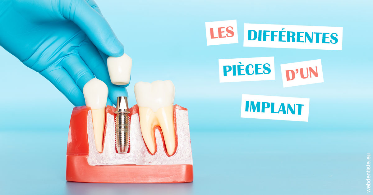 https://dr-taverniers-jeroen.chirurgiens-dentistes.fr/Les différentes pièces d’un implant 2