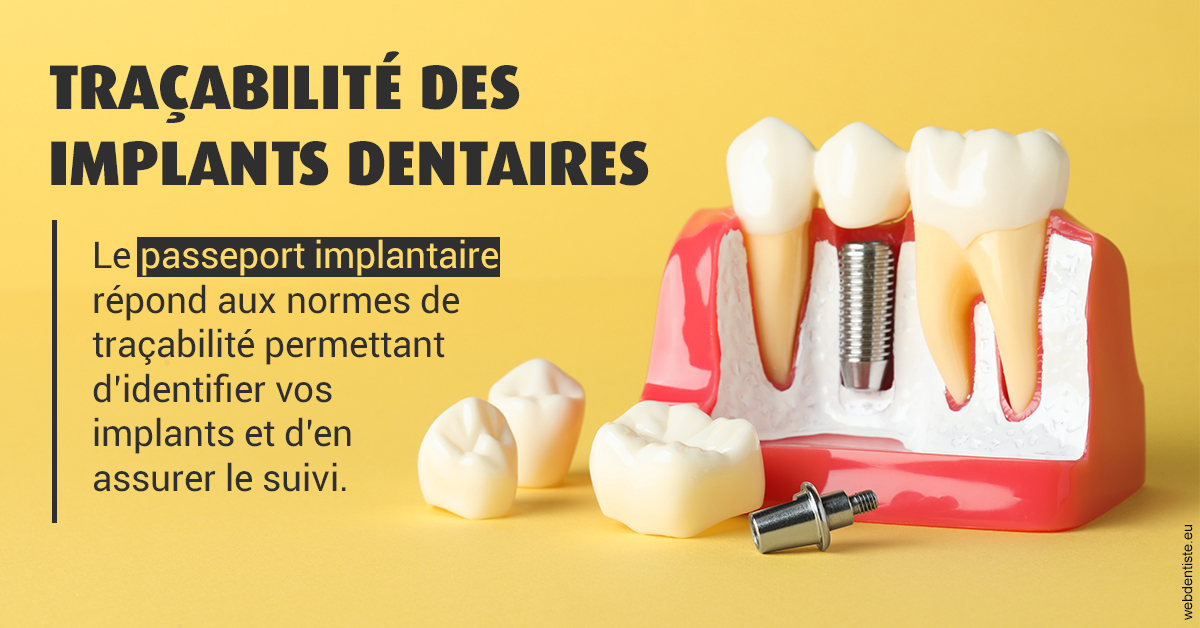 https://dr-taverniers-jeroen.chirurgiens-dentistes.fr/T2 2023 - Traçabilité des implants 2