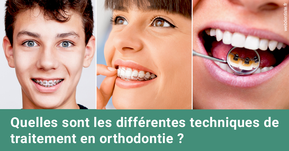 https://dr-taverniers-jeroen.chirurgiens-dentistes.fr/Les différentes techniques de traitement 2