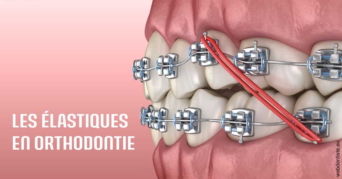https://dr-taverniers-jeroen.chirurgiens-dentistes.fr/Elastiques orthodontie 2